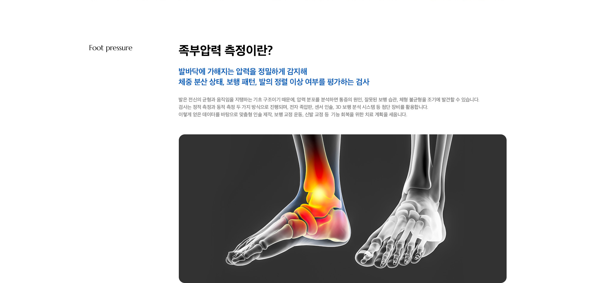 [족부압력 측정이란?] 발바닥에 가해지는 압력을 정밀하게 감지해 체중 분산 상태, 보행 패턴, 발의 정렬 이상 여부를 평가하는 검사) 발은 전신의 균형과 움직임을 지탱하는 기초 구조이기 때문에, 압력 분포를 분석하면 통증의 원인, 잘못된 보행 습관, 체형 불균형을 조기에 발견할 수 있습니다. 검사는 정적 측정과 동적 측정 두 가지 방식으로 진행되며, 전자 족압판, 센서 인솔, 3D 보행 분석 시스템 등 첨단 장비를 활용합니다. 이렇게 얻은 데이터를 바탕으로 맞춤형 인솔 제작, 보행 교정 운동, 신발 교정 등  기능 회복을 위한 치료 계획을 세웁니다.