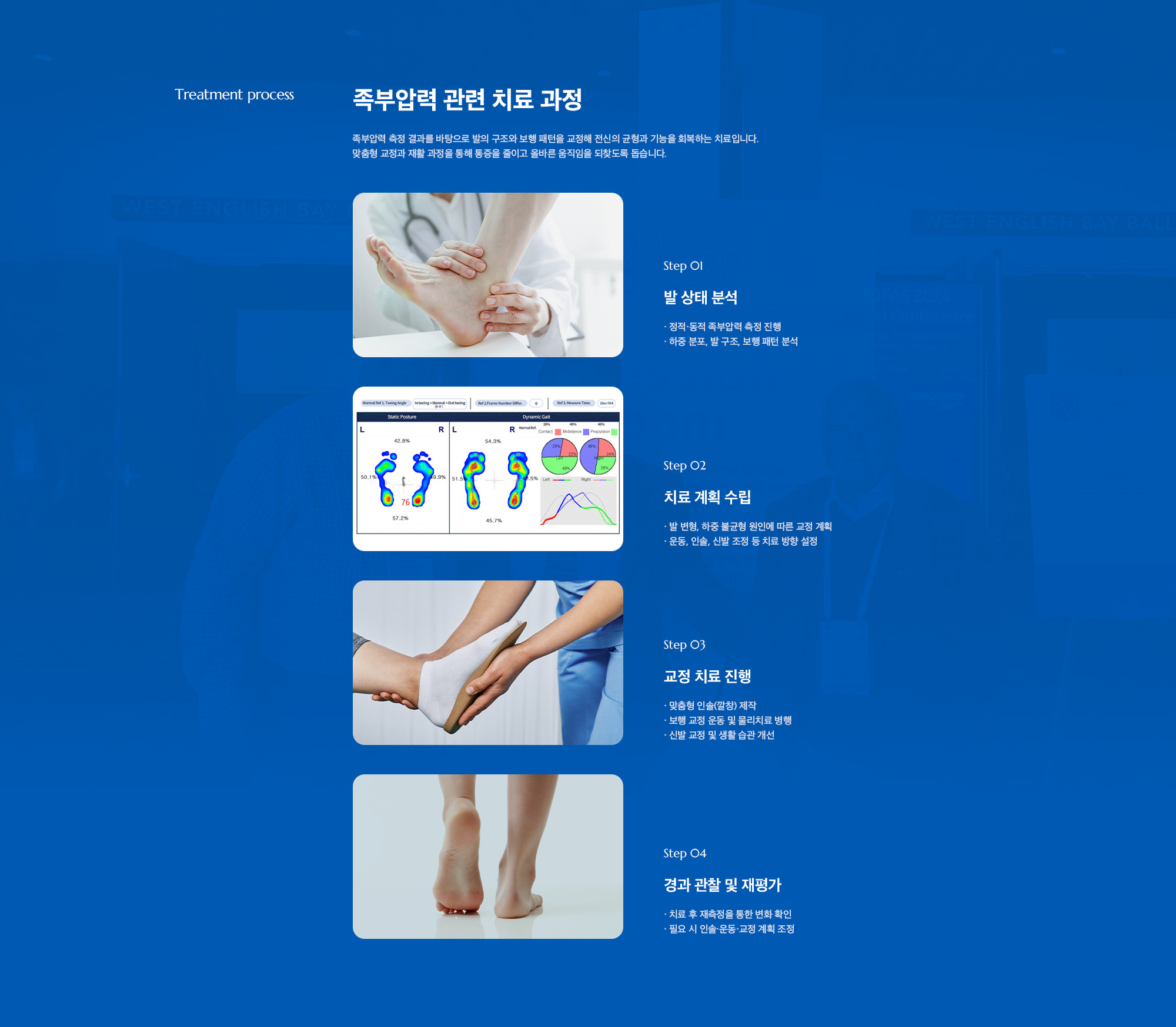 [족부압력 관련 치료 과정] 족부압력 측정 결과를 바탕으로 발의 구조와 보행 패턴을 교정해 전신의 균형과 기능을 회복하는 치료입니다. 맞춤형 교정과 재활 과정을 통해 통증을 줄이고 올바른 움직임을 되찾도록 돕습니다. (Step 01. 발 상태 분석 / Step 02. 치료 계획 수립 / Step 03. 교정 치료 진행 / Step 04. 경과 관찰 및 재평가)